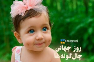 چال گونه